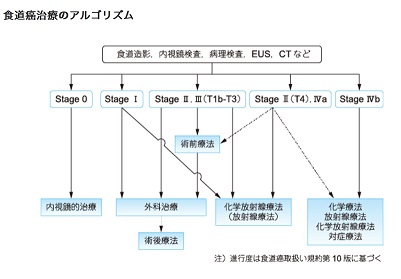 食道癌治療のアルゴリズム